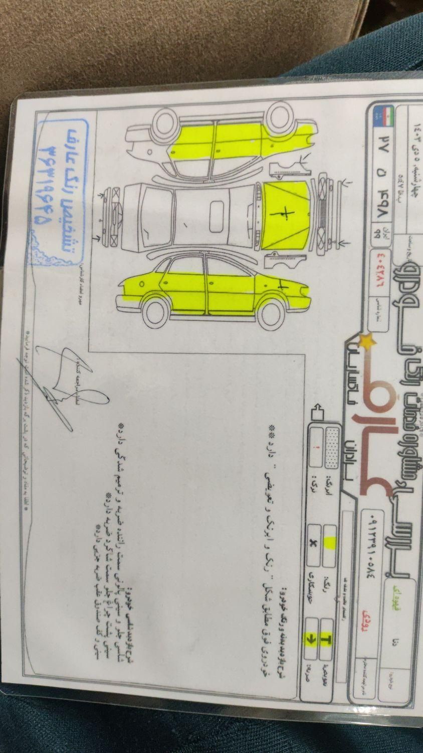 دنا معمولی دنده ای تیپ ۲ - 1395