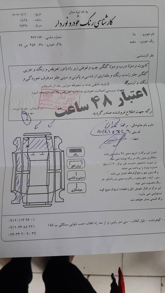 دنا معمولی دنده ای تیپ ۲ - 1396