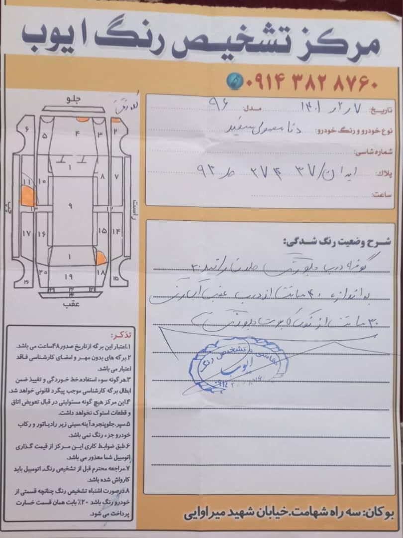 دنا معمولی دنده ای تیپ ۲ - 1396