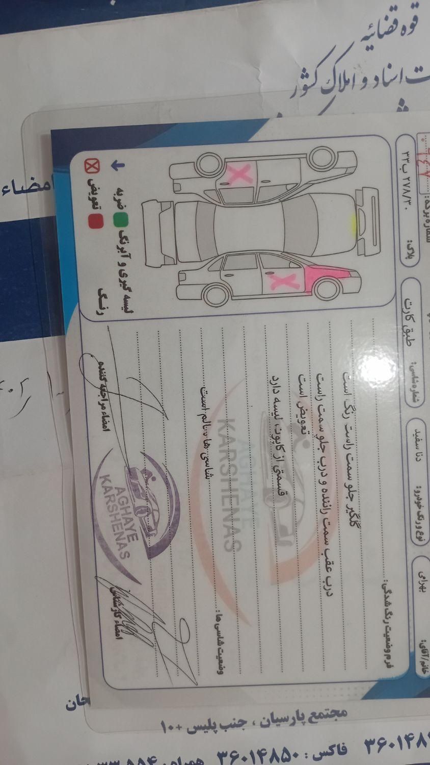 دنا معمولی دنده ای تیپ ۲ - 1397