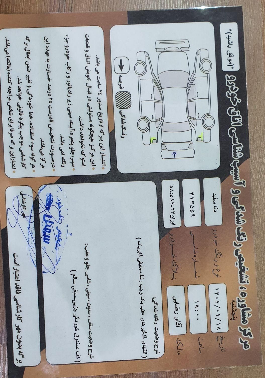 دنا معمولی دنده ای تیپ ۲ - 1395