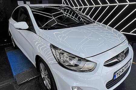 هیوندای اکسنت 1.6 لیتر ساده - 2014