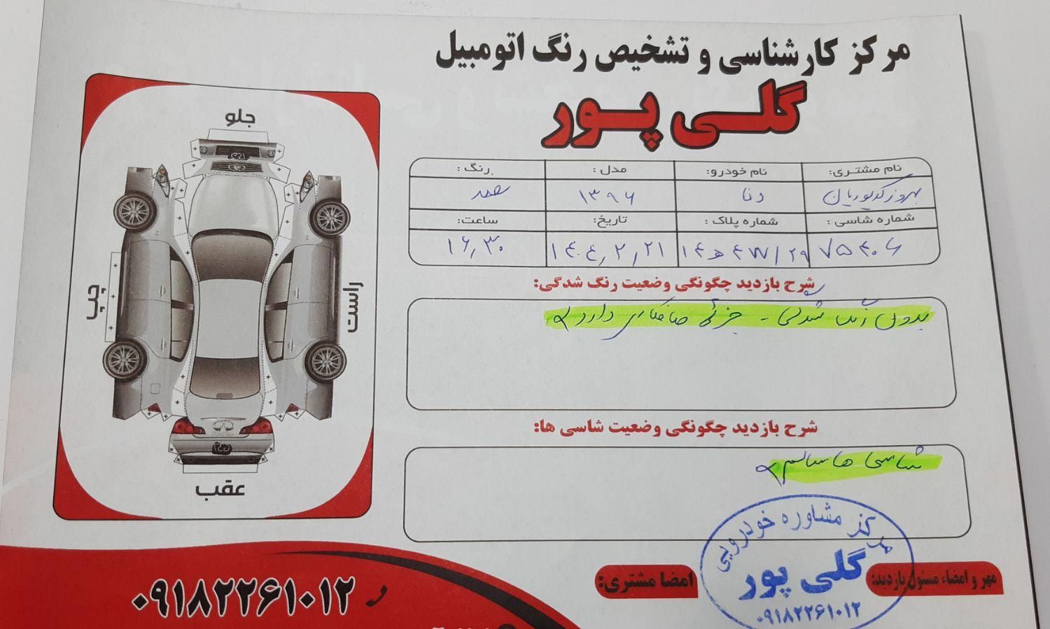 دنا معمولی دنده ای تیپ ۲ - 1396