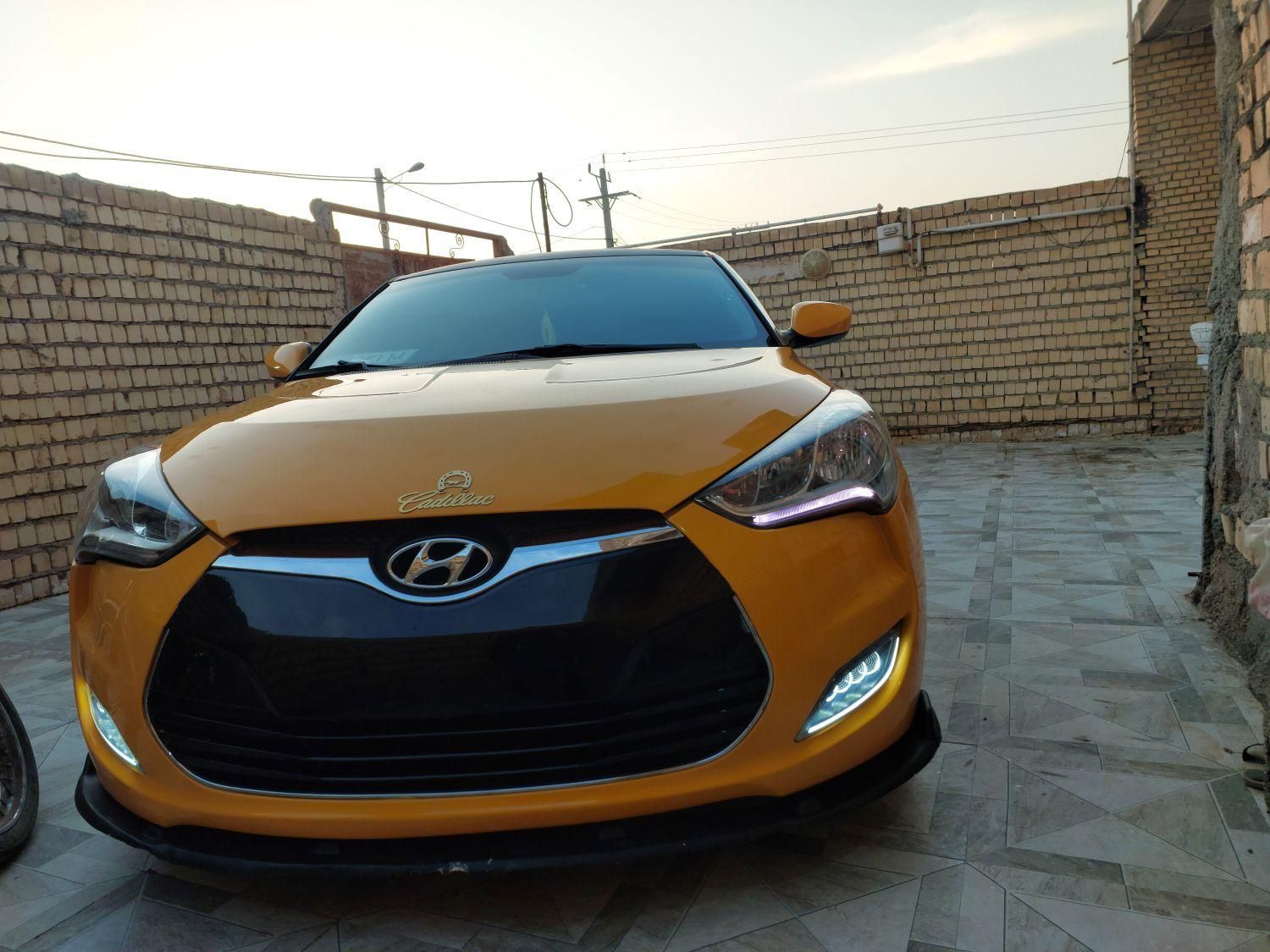 هیوندای ولستر فول موتور MPI - 2015