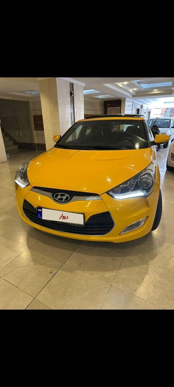هیوندای ولستر فول موتور MPI - 2016