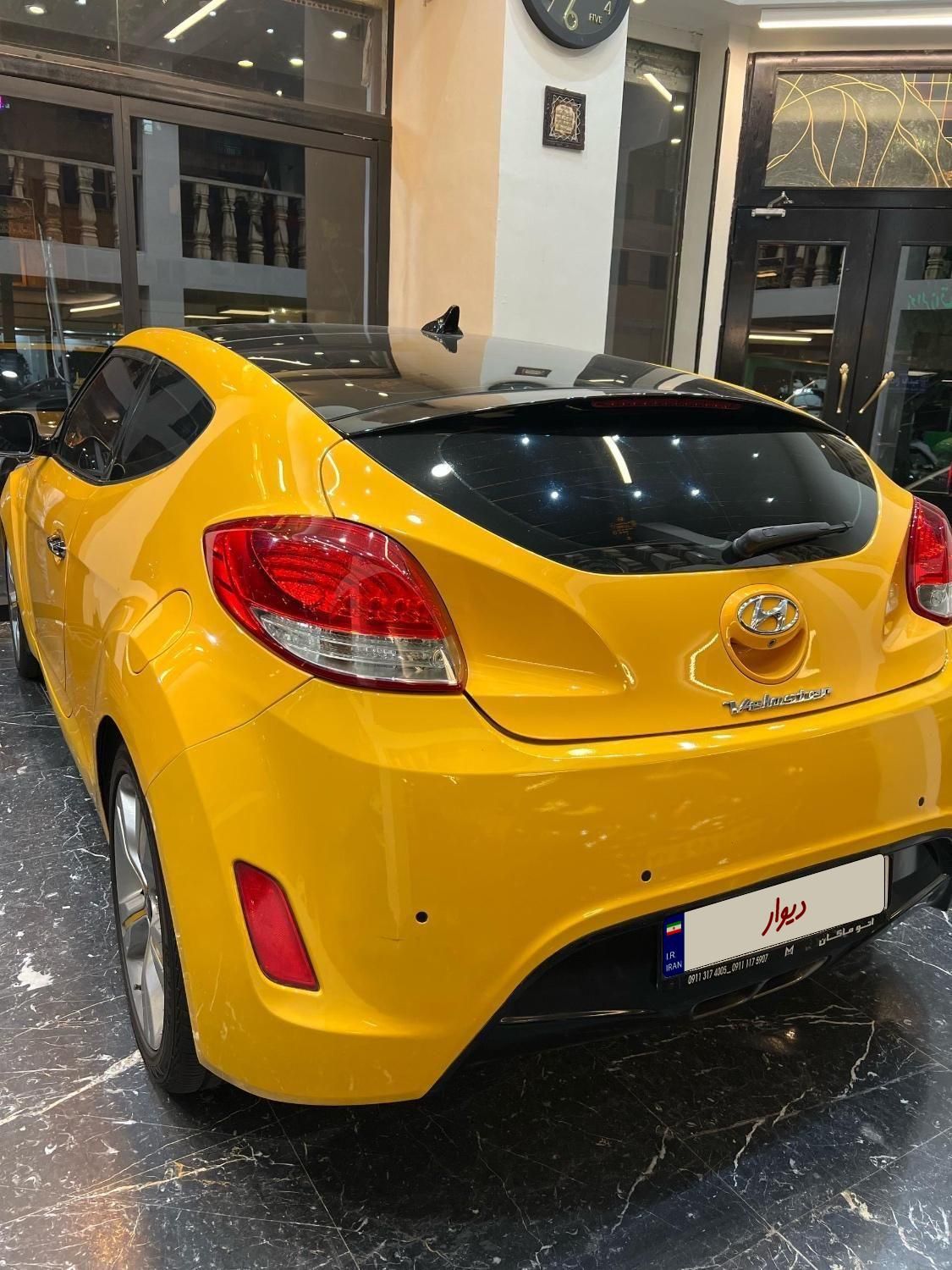 هیوندای ولستر فول موتور MPI - 2014