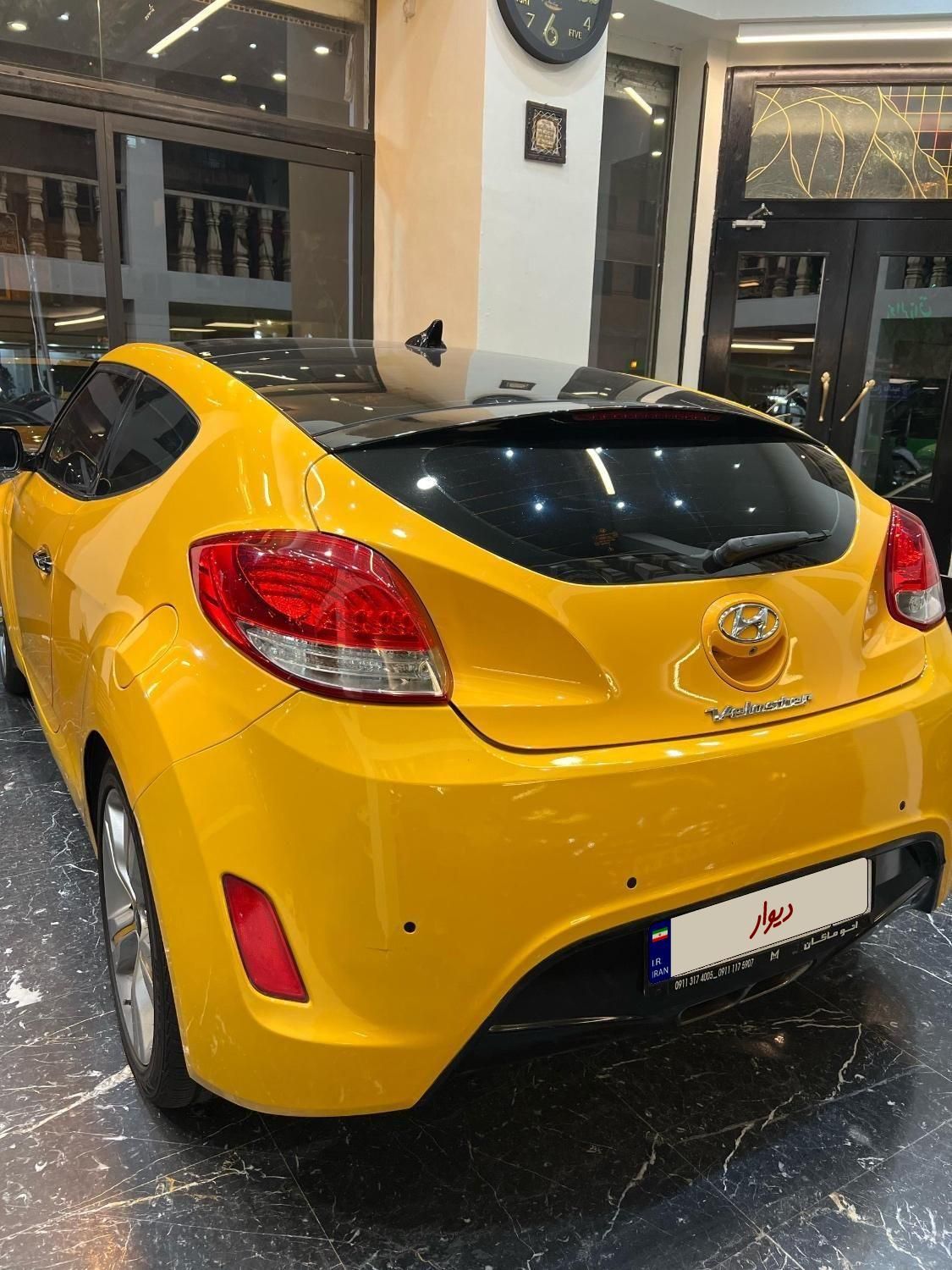 هیوندای ولستر فول موتور MPI - 2014