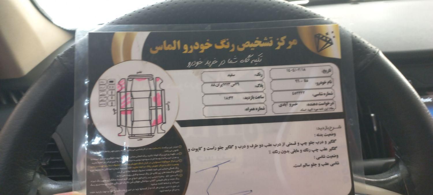 دنا معمولی دنده ای تیپ ۲ - 1396