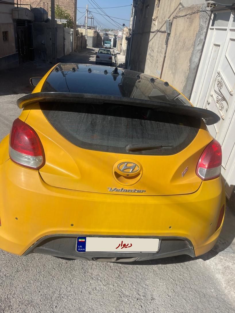هیوندای ولستر فول موتور MPI - 2014