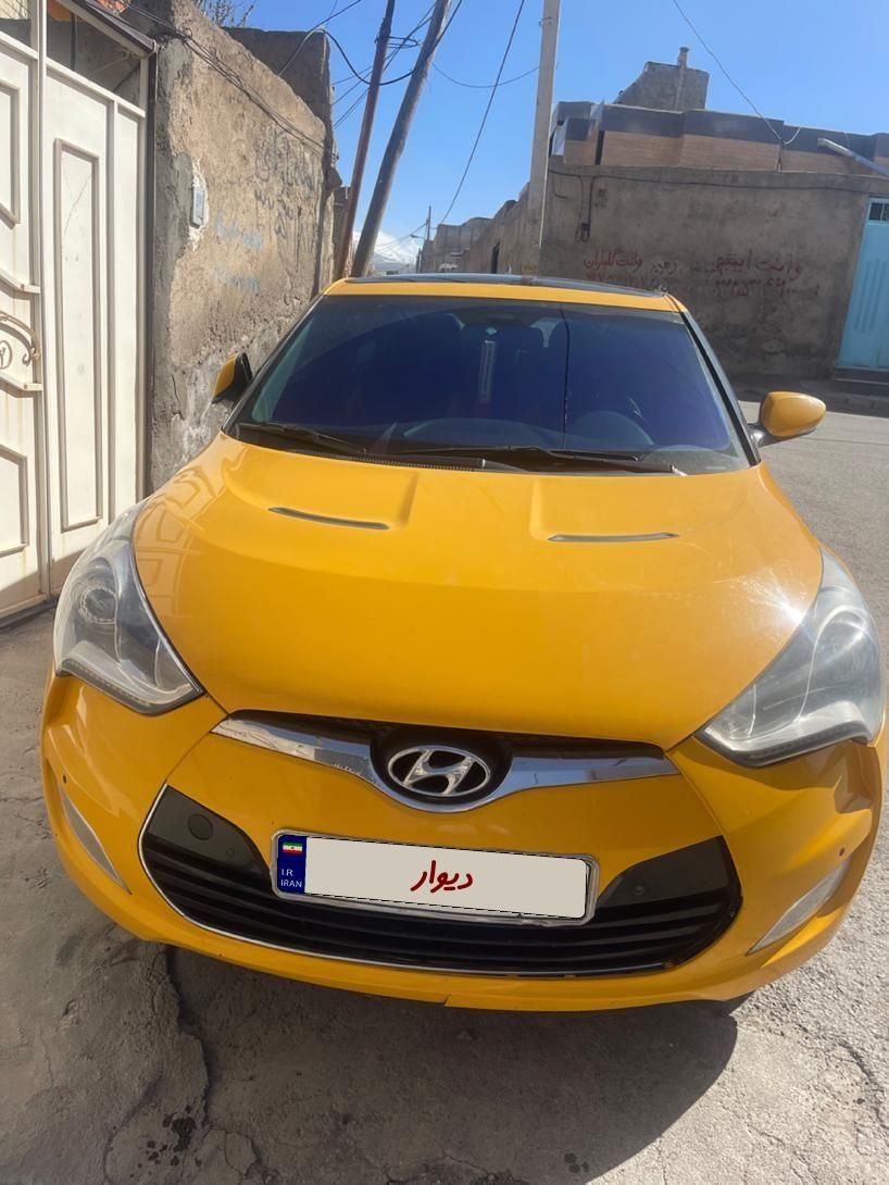 خودرو هیوندای، ولستر آگهی ann_18048094
