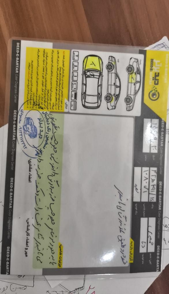 دنا معمولی دنده ای تیپ ۲ - 1397