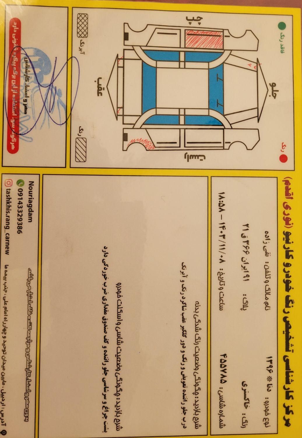 دنا معمولی دنده ای تیپ ۲ - 1396