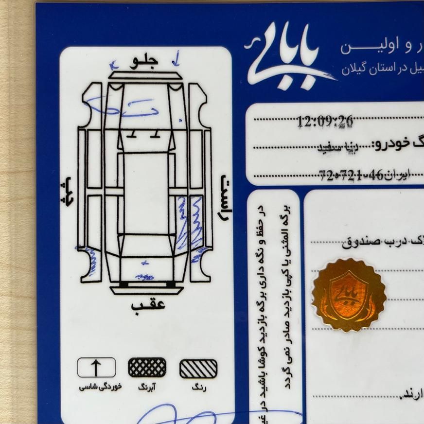 دنا معمولی دنده ای تیپ ۲ - 1396
