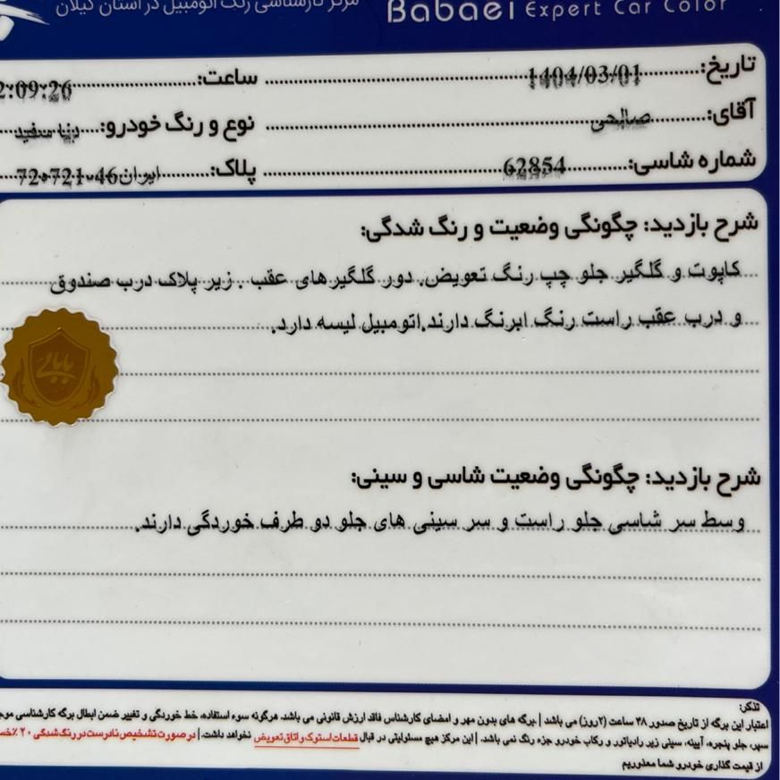 دنا معمولی دنده ای تیپ ۲ - 1396