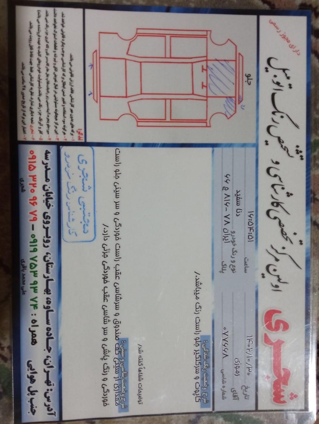 دنا معمولی دنده ای تیپ ۲ - 1397