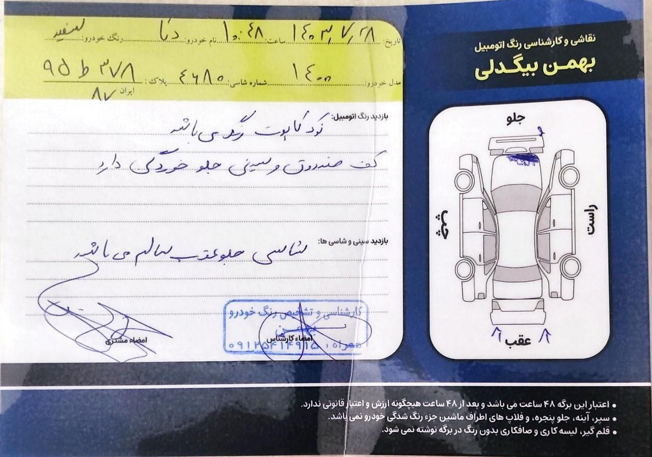 دنا معمولی دنده ای تیپ ۲ - 1400
