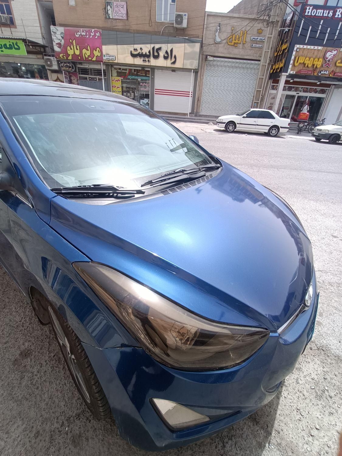هیوندای النترا (مونتاژ) فول مونتاژ AD - 2018