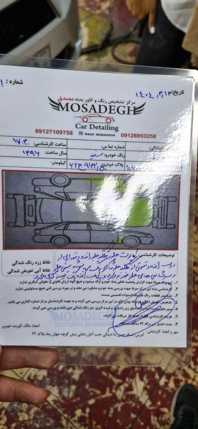دنا معمولی تیپ ۲ - 1396