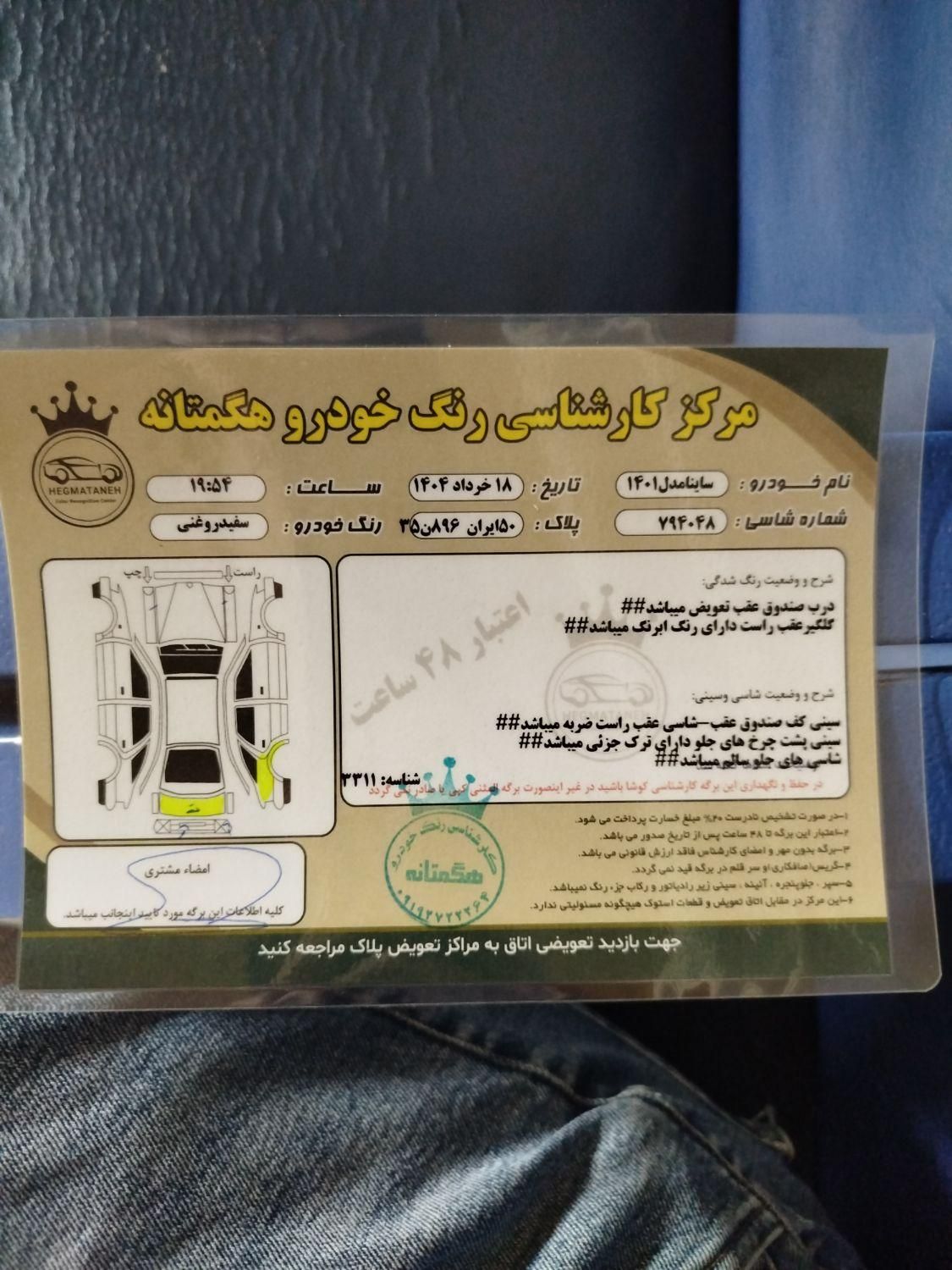 ساینا EX معمولی - 1401