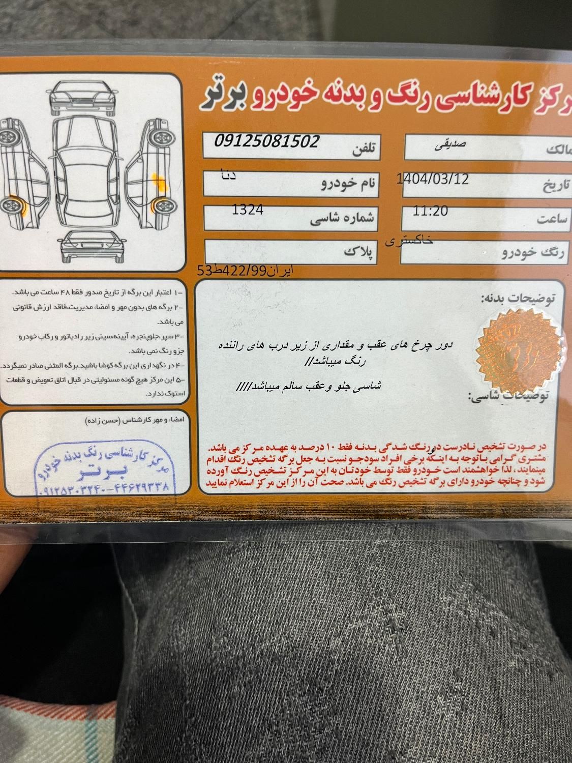 دنا معمولی تیپ ۲ - 1395