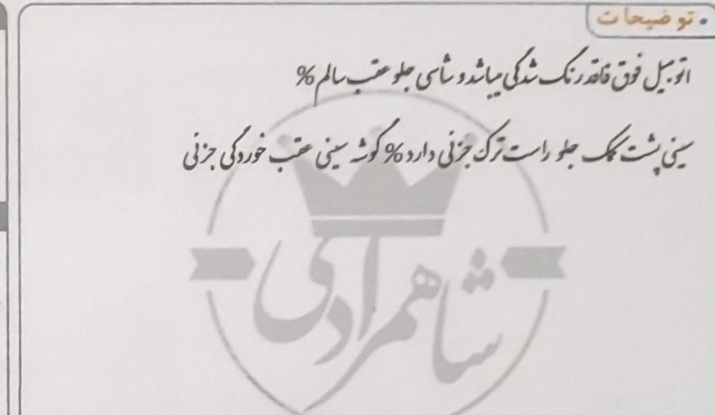 ساینا EX معمولی - 1397