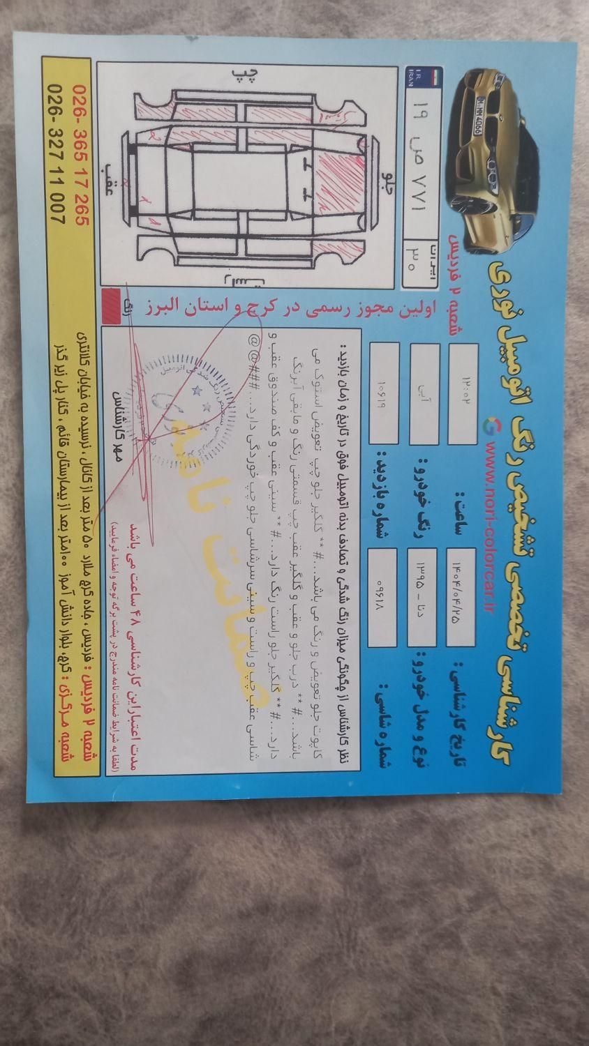 دنا معمولی تیپ ۲ - 1395