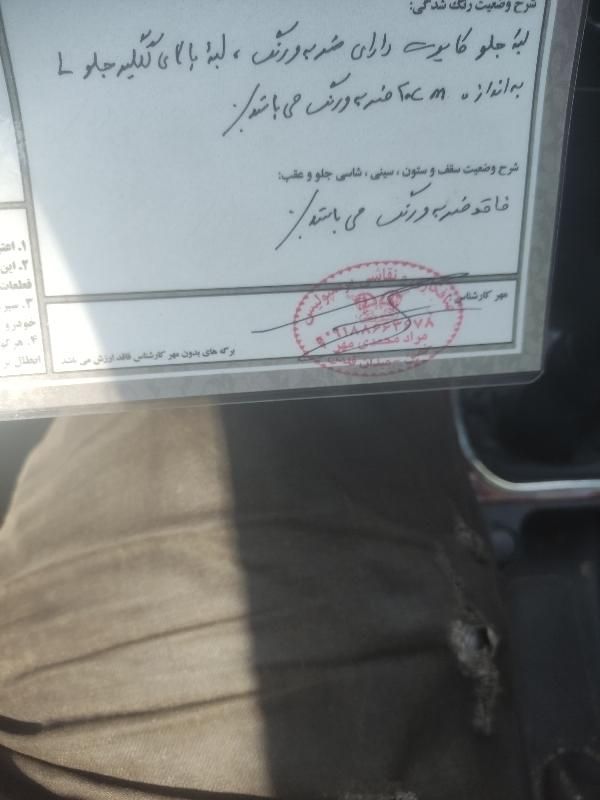 دنا معمولی تیپ ۲ - 1398