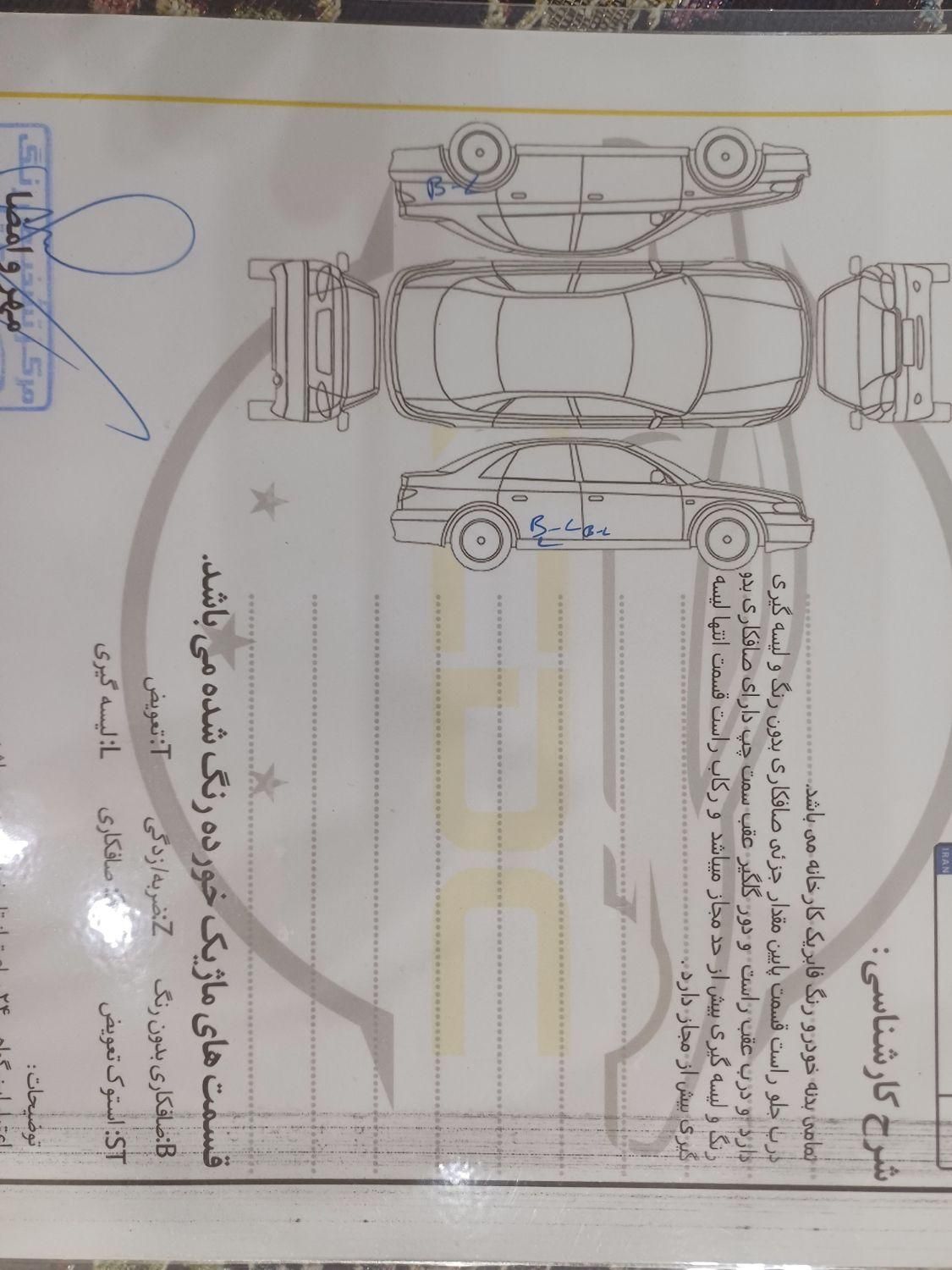 دنا معمولی تیپ ۱ - 1399