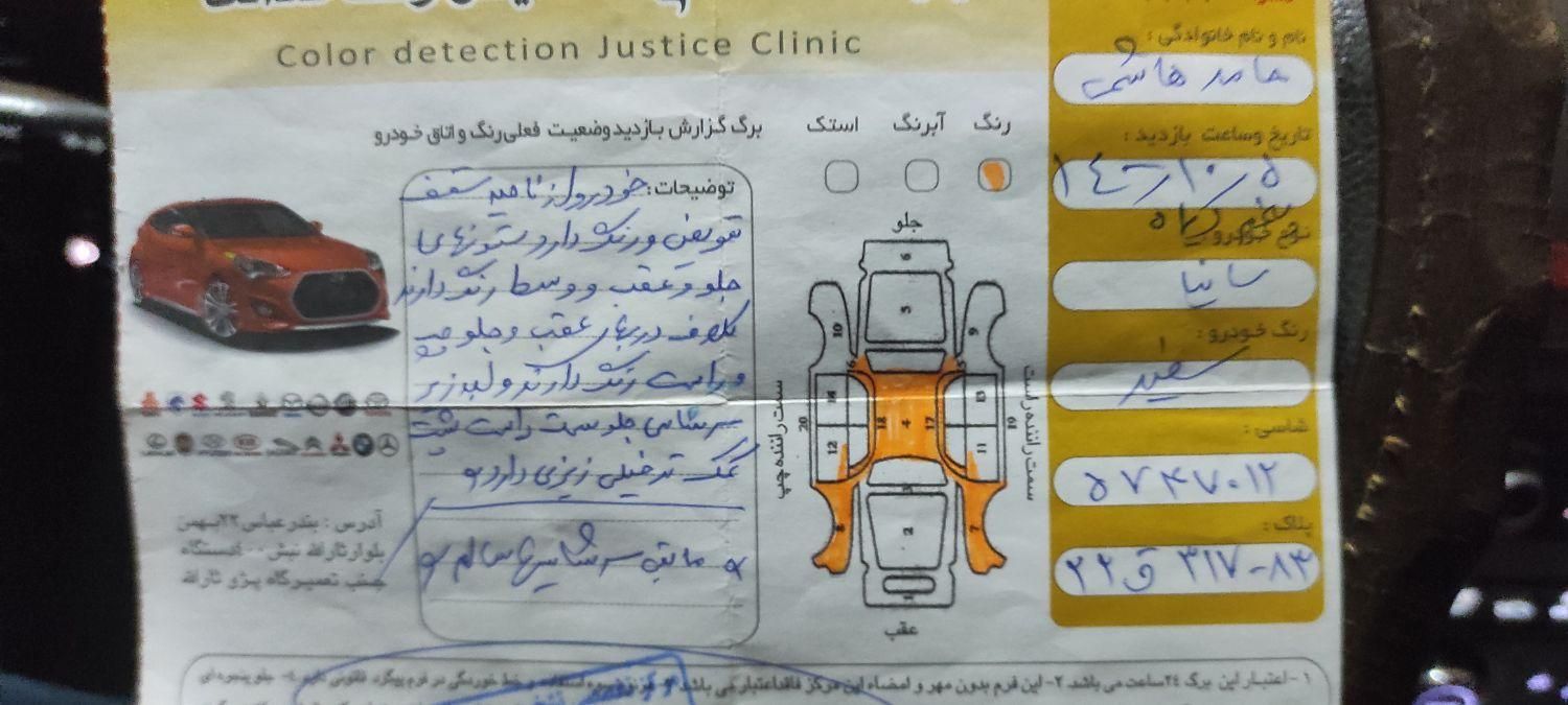 ساینا EX معمولی - 1396