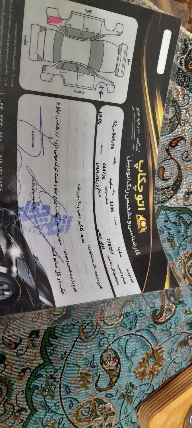 ساینا EX معمولی - 1396