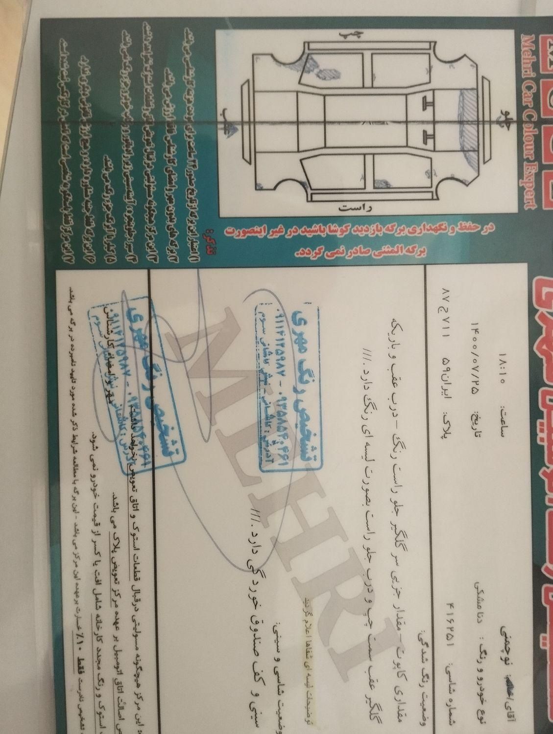 دنا معمولی تیپ ۲ - 1395