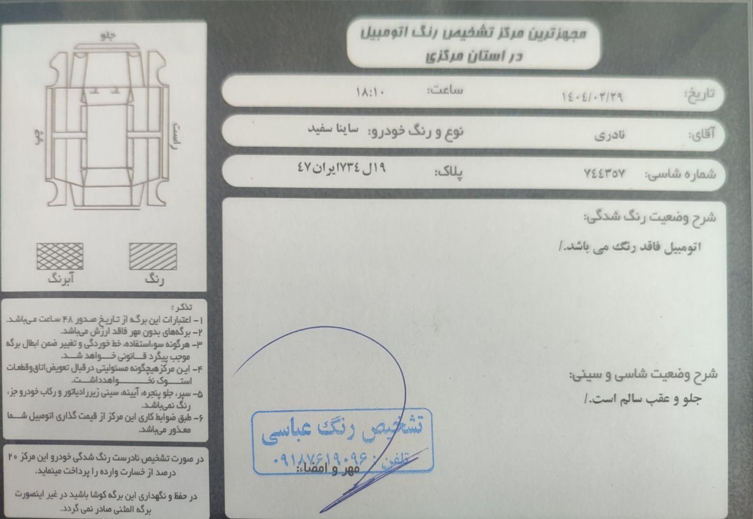 ساینا EX معمولی - 1401