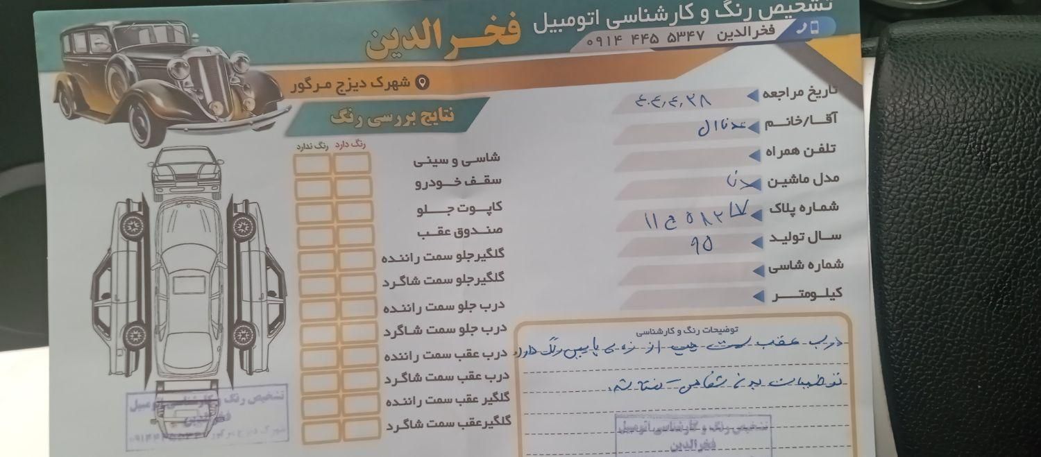 دنا معمولی تیپ ۲ - 1395