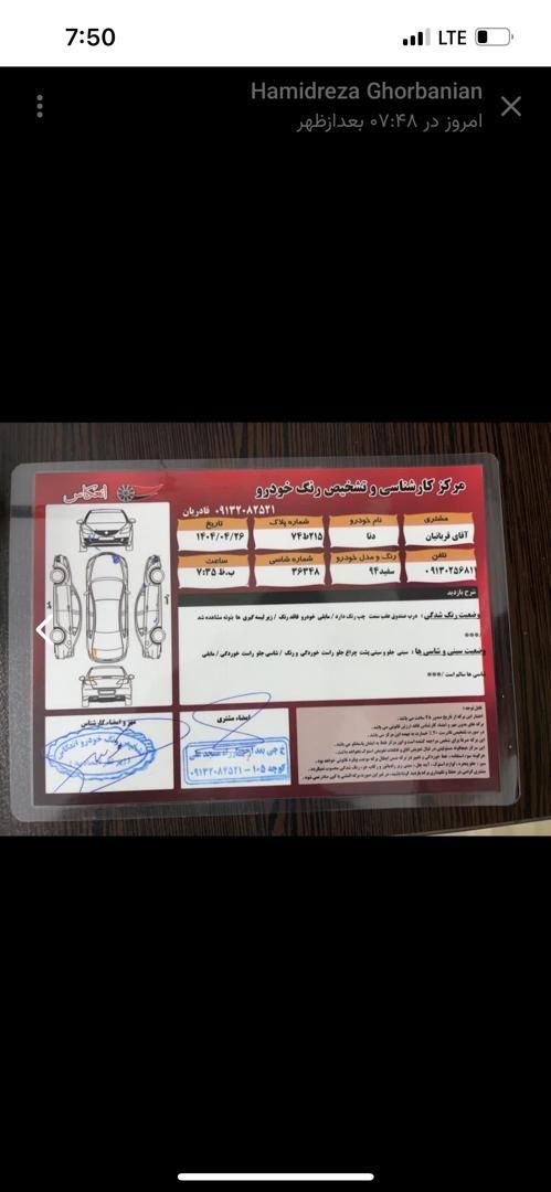 دنا معمولی تیپ ۲ - 1394