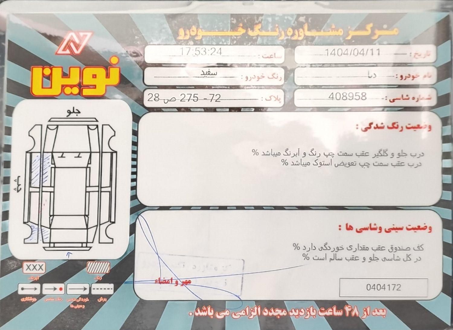 دنا معمولی تیپ ۲ - 1395