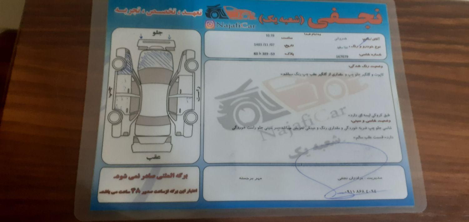 دنا معمولی تیپ ۲ - 1398