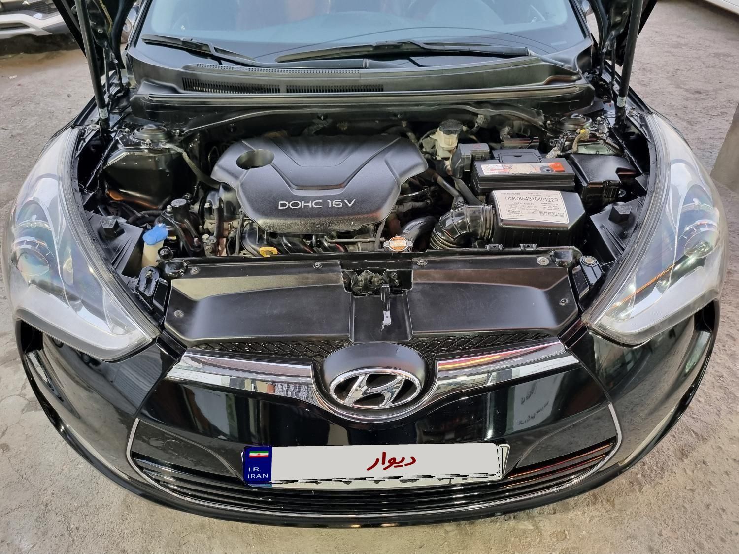 هیوندای ولستر فول موتور MPI - 2014