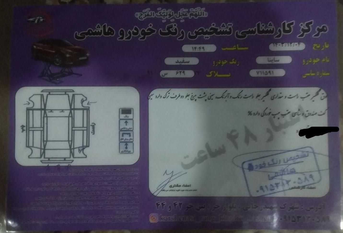 ساینا EX معمولی - 1395