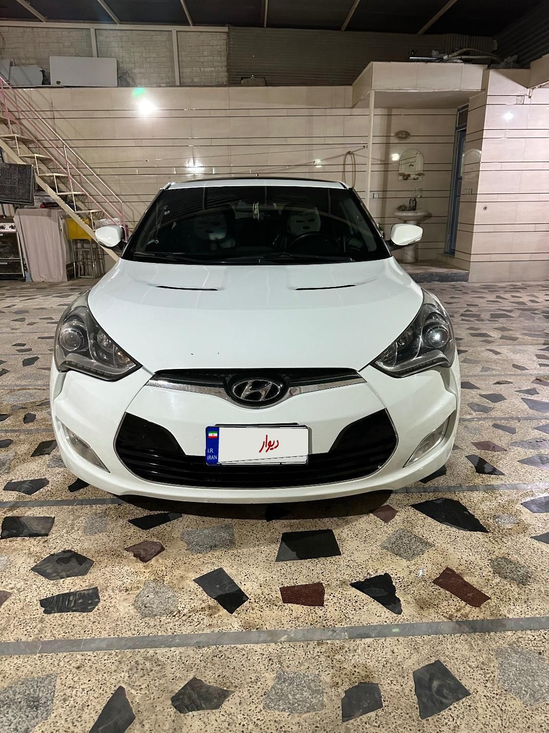 هیوندای ولستر فول موتور MPI - 2015