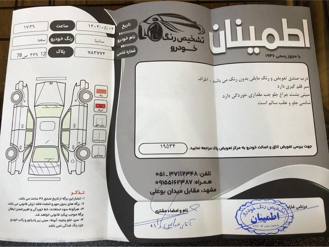 ساینا EX معمولی - 1401