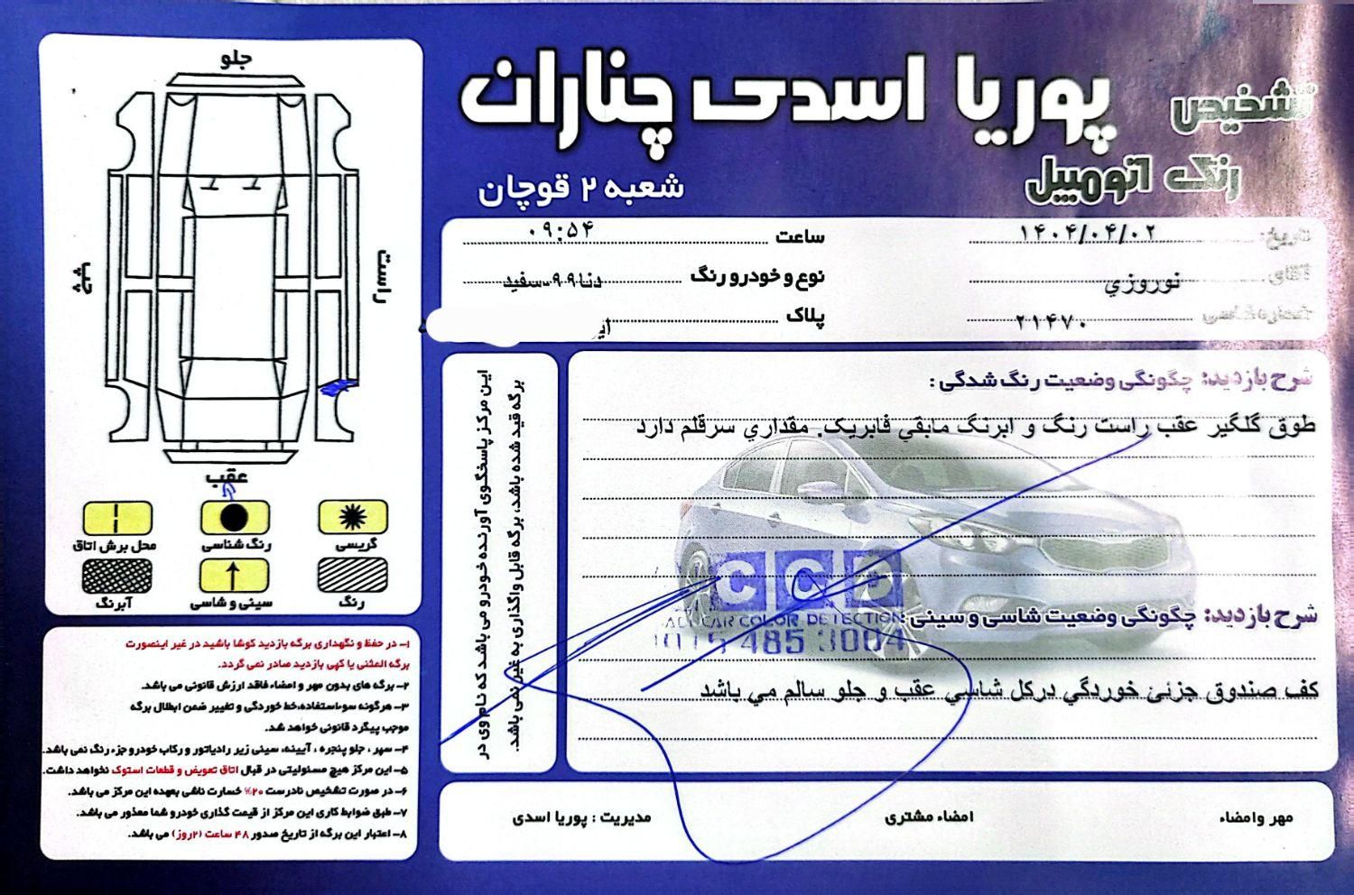 دنا معمولی تیپ ۱ - 1399
