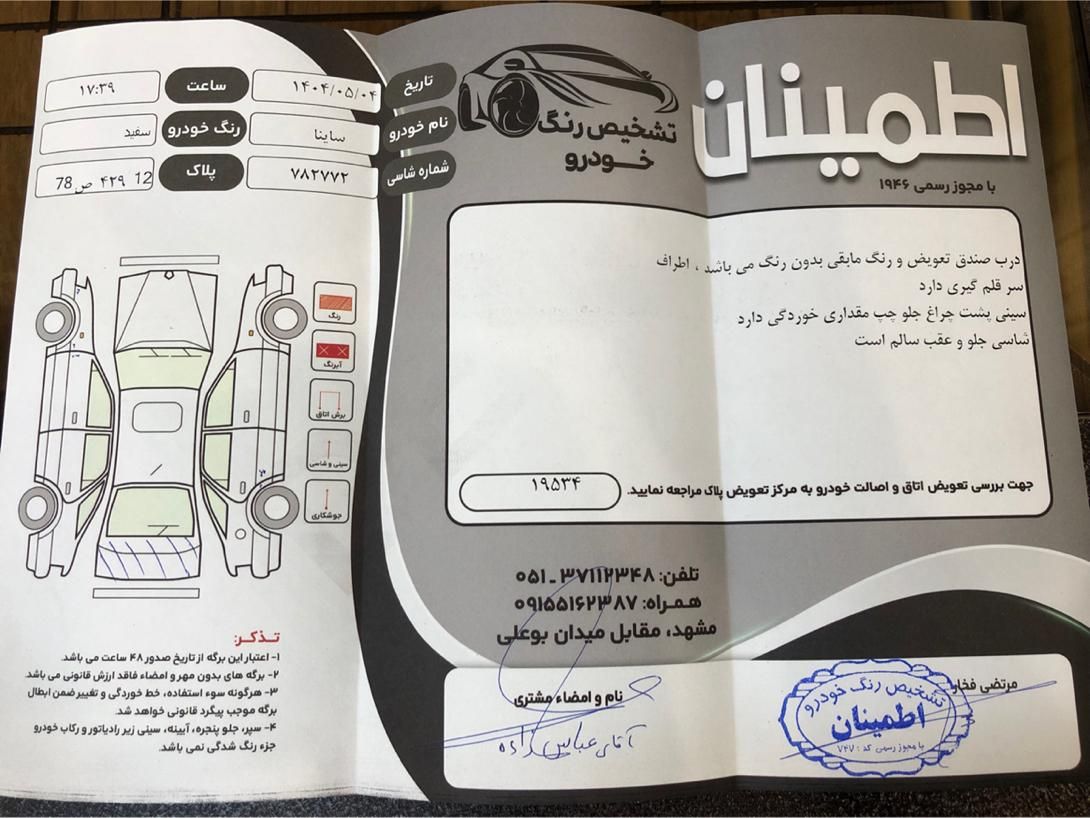 ساینا EX معمولی - 1401