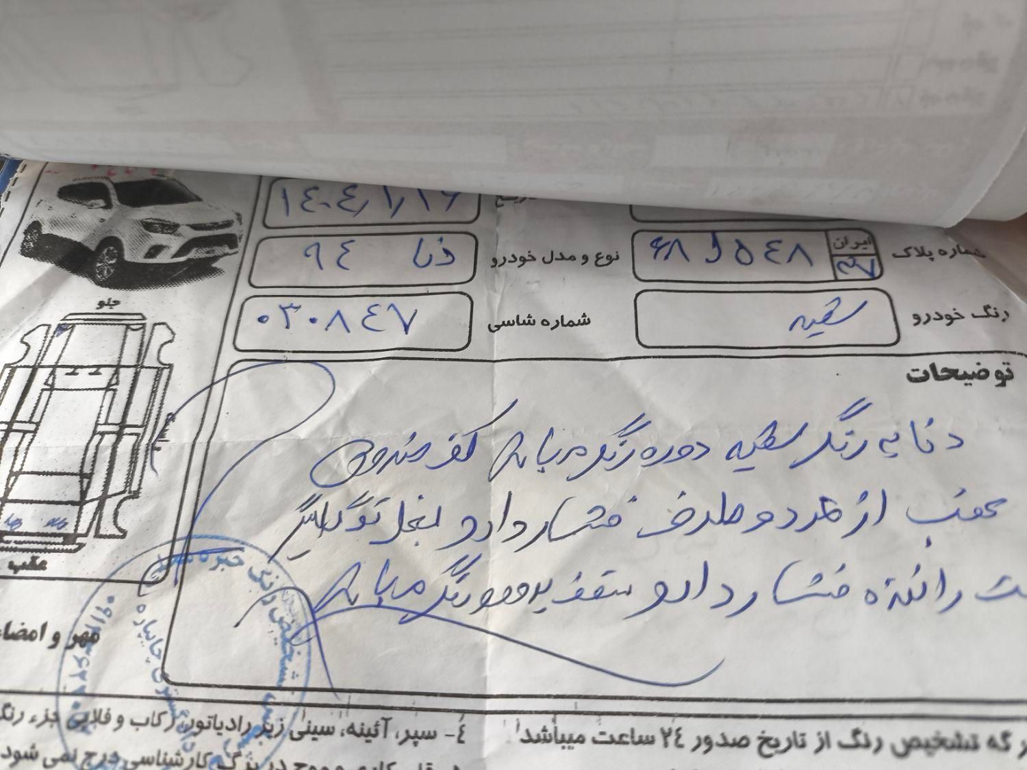 دنا معمولی تیپ ۲ - 1394