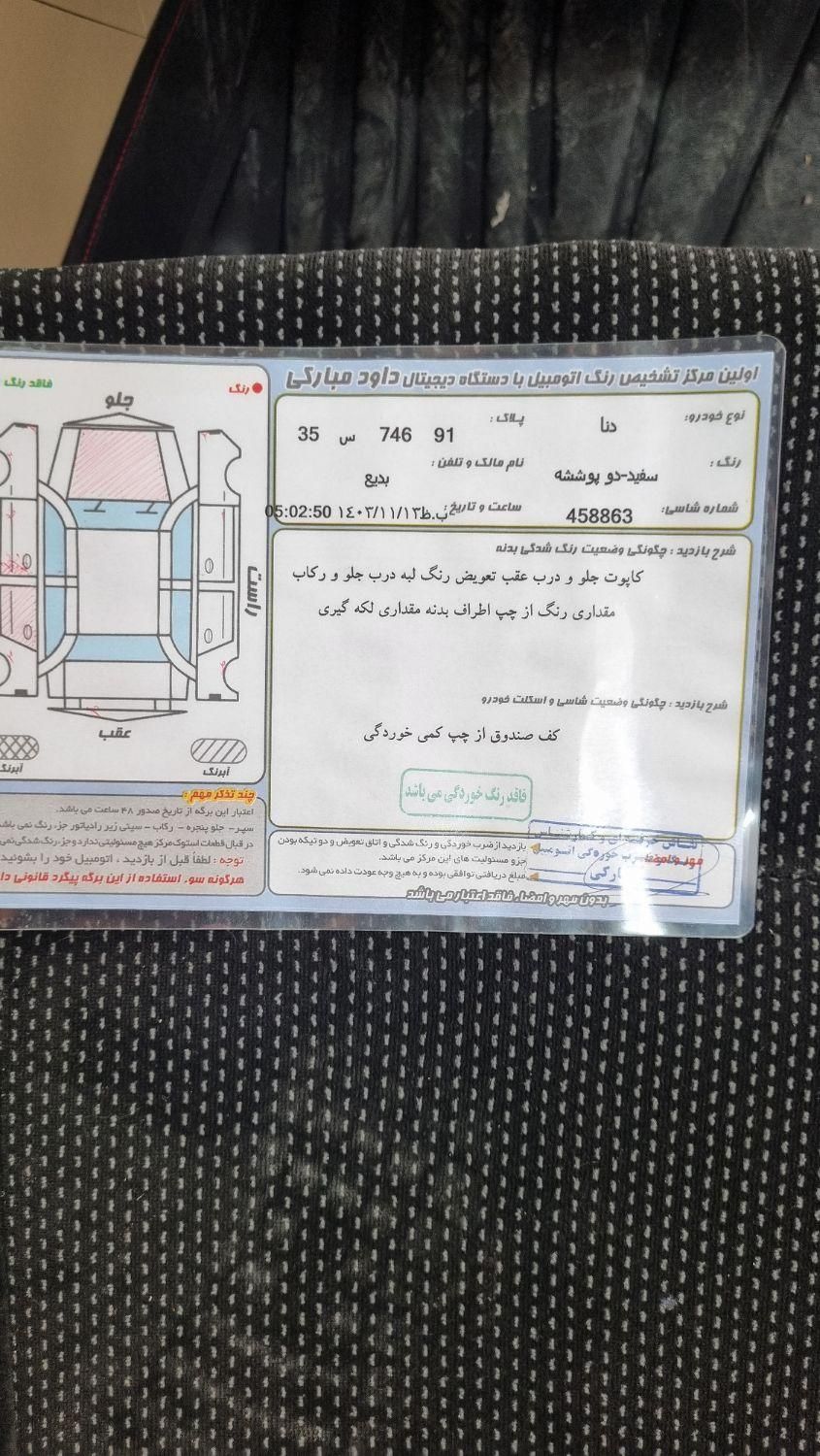 دنا معمولی تیپ ۲ - 1396
