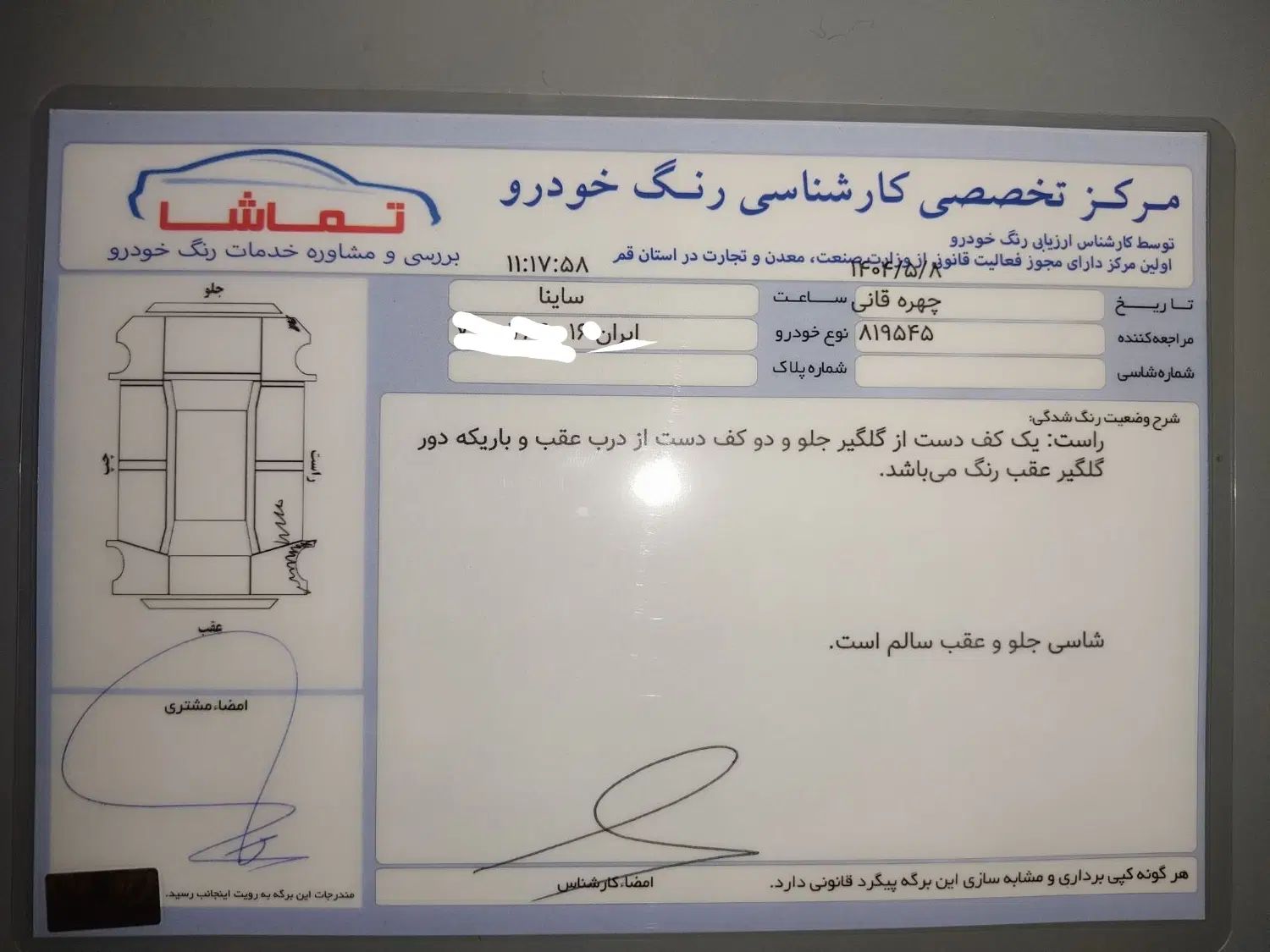 ساینا EX معمولی - 1398