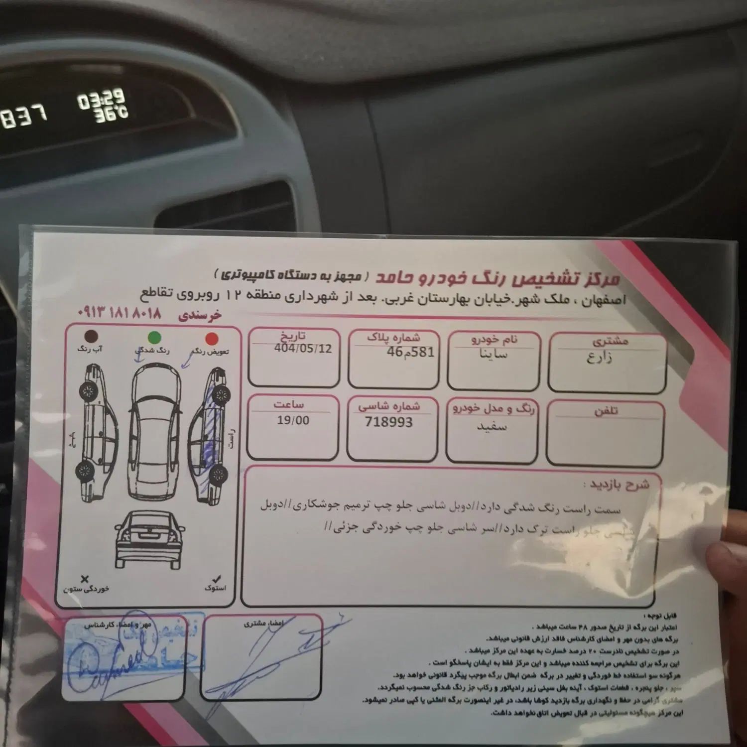ساینا EX معمولی - 1396