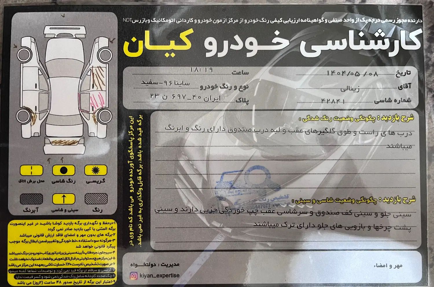 ساینا EX معمولی - 1396