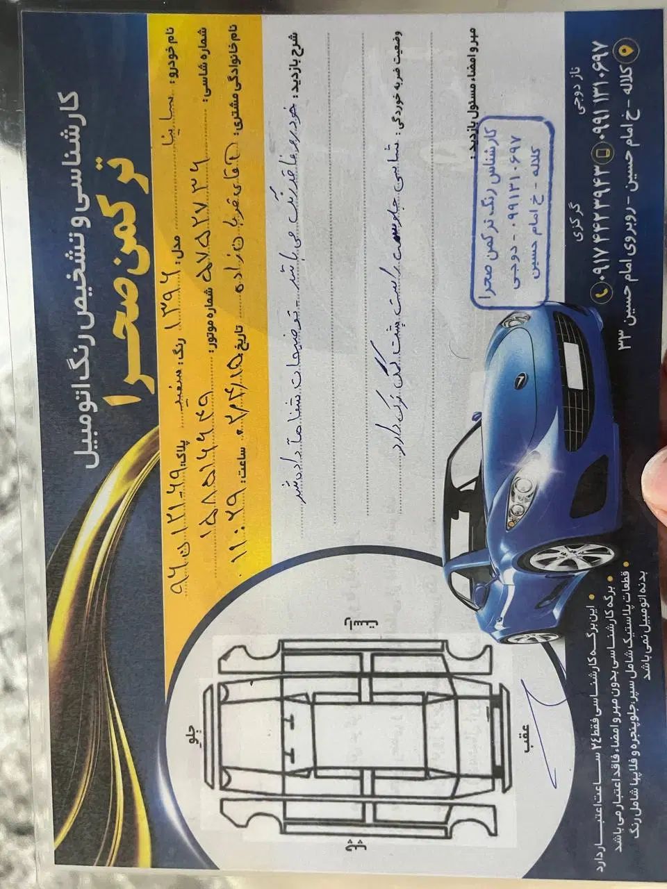 ساینا EX معمولی - 1396