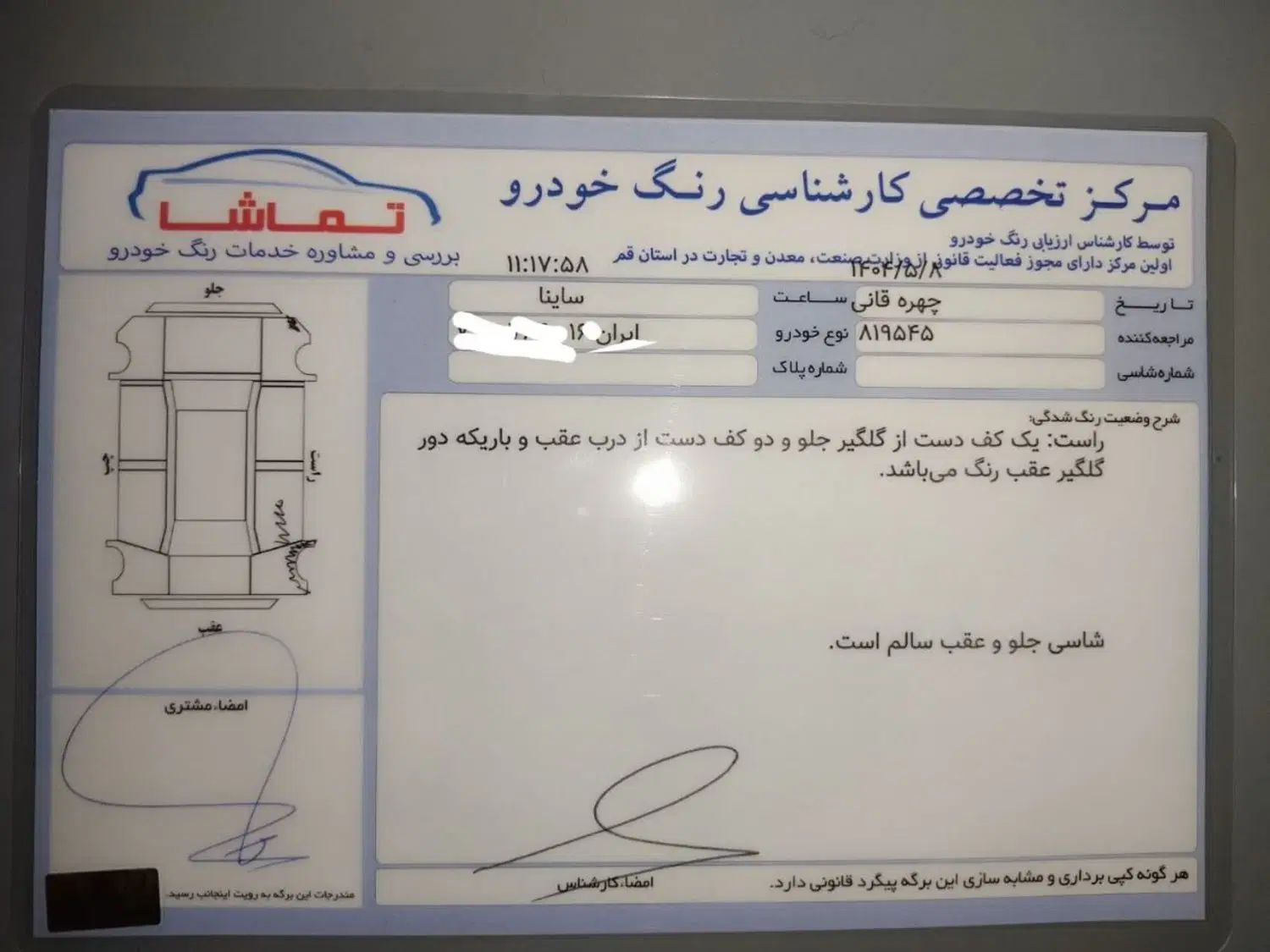 ساینا EX معمولی - 1398