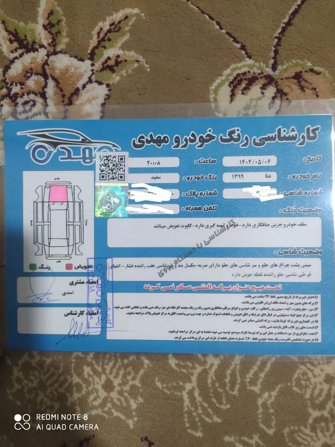 دنا معمولی تیپ ۱ - 1399